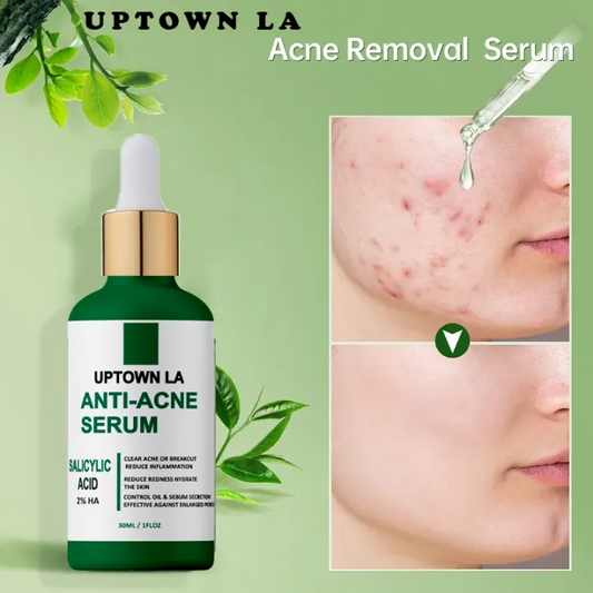 UPTOWN LA Anti-Acne Serum-Oil control 30ml